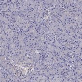 Anti-SCNN1D antibody produced in rabbit Prestige Antibodies&#174; Powered by Atlas Antibodies, affinity isolated antibody, buffered aqueous glycerol solution