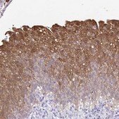 Anti-IDH1 antibody produced in rabbit Prestige Antibodies&#174; Powered by Atlas Antibodies, affinity isolated antibody, buffered aqueous glycerol solution