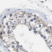 Anti-PGR antibody produced in rabbit Prestige Antibodies&#174; Powered by Atlas Antibodies, affinity isolated antibody, buffered aqueous glycerol solution