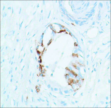Anti-SPINK1 antibody, Rabbit monoclonal clone SP166, recombinant, expressed in proprietary host, affinity isolated antibody