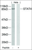 Anti-STAT4 (Ab-693) antibody produced in rabbit affinity isolated antibody
