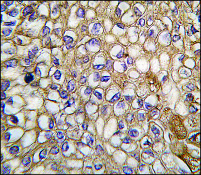 Anti-ALOX5AP (C-term) antibody produced in rabbit saturated ammonium sulfate (SAS) precipitated, buffered aqueous solution