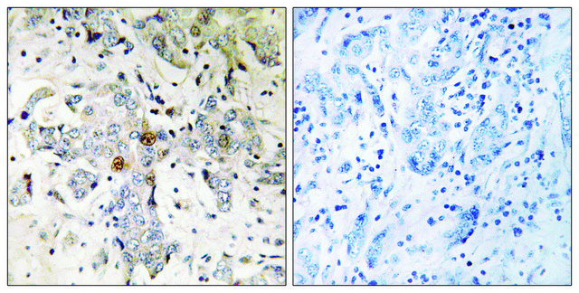 Anti-ZCCHC17 antibody produced in rabbit affinity isolated antibody