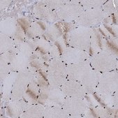 Anti-RPUSD4 antibody produced in rabbit Prestige Antibodies&#174; Powered by Atlas Antibodies, affinity isolated antibody, buffered aqueous glycerol solution