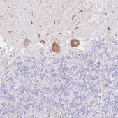 Anti-DKK4 antibody produced in rabbit Prestige Antibodies&#174; Powered by Atlas Antibodies, affinity isolated antibody, buffered aqueous glycerol solution