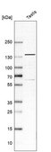 Anti-USP25 antibody produced in rabbit Prestige Antibodies&#174; Powered by Atlas Antibodies, affinity isolated antibody, buffered aqueous glycerol solution