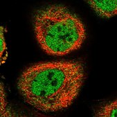 Anti-RRM2B antibody produced in rabbit Prestige Antibodies&#174; Powered by Atlas Antibodies, affinity isolated antibody, buffered aqueous glycerol solution