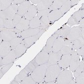 Anti-NCF2 antibody produced in rabbit Ab1, Prestige Antibodies&#174; Powered by Atlas Antibodies, affinity isolated antibody, buffered aqueous glycerol solution