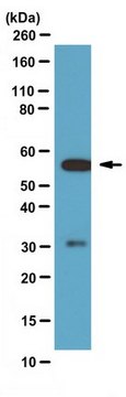 Anti-Calcineurin pan A Antibody from rabbit, purified by affinity chromatography