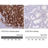 Anti-CYP21A2 antibody produced in rabbit Prestige Antibodies&#174; Powered by Atlas Antibodies, affinity isolated antibody, buffered aqueous glycerol solution