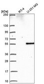 Anti-PIP4K2B antibody produced in rabbit Prestige Antibodies&#174; Powered by Atlas Antibodies, affinity isolated antibody