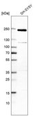 Anti-TSC2 antibody produced in rabbit Prestige Antibodies&#174; Powered by Atlas Antibodies, affinity isolated antibody, buffered aqueous glycerol solution