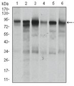 Anti-TGFBR3, clone 1C5H11 Antibody ascites fluid, clone 1C5H11, from mouse
