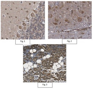 Anti-TRPA1 Antibody from rabbit, purified by affinity chromatography