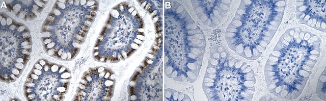 Anti-PEX14 Antibody, clone 1D7 ZooMAb&#174; Rabbit Monoclonal recombinant, expressed in HEK 293 cells