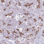 Anti-SLC4A4 antibody produced in rabbit Prestige Antibodies&#174; Powered by Atlas Antibodies, affinity isolated antibody, buffered aqueous glycerol solution