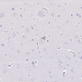 Anti-CD177 antibody produced in rabbit Prestige Antibodies&#174; Powered by Atlas Antibodies, affinity isolated antibody