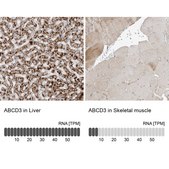 Anti-ABCD3 antibody produced in rabbit Prestige Antibodies&#174; Powered by Atlas Antibodies, affinity isolated antibody, buffered aqueous glycerol solution