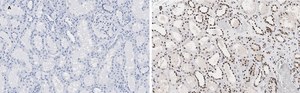 Anti-HMGB1 Antibody, clone 3K6, ZooMAb&#174; Rabbit Monoclonal recombinant, expressed in HEK 293 cells