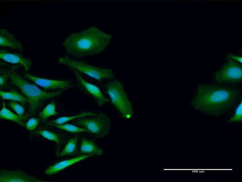 Anti-PCID2 antibody produced in rabbit purified immunoglobulin, buffered aqueous solution