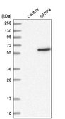 Anti-SFRP4 antibody produced in rabbit Prestige Antibodies&#174; Powered by Atlas Antibodies, affinity isolated antibody, buffered aqueous glycerol solution