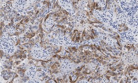 Anti-Integrin &#945;V&#946;8 Antibody, clone EM13309 , ZooMAb&#174; Rabbit Monoclonal recombinant, expressed in HEK 293 cells