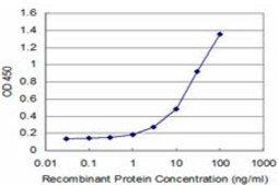 Monoclonal Anti-SNCB antibody produced in mouse clone 3H4, purified immunoglobulin, buffered aqueous solution