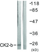 Anti-CKII-&#946; antibody produced in rabbit affinity isolated antibody