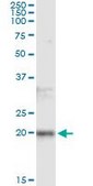 Monoclonal Anti-FTL antibody produced in mouse clone 4C10, purified immunoglobulin, buffered aqueous solution