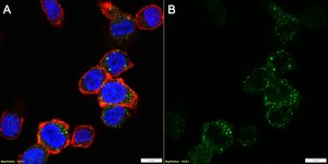 Anti-TLR2 Antibody, clone 1J19 ZooMAb&#174; Rabbit Monoclonal recombinant, expressed in HEK 293 cells