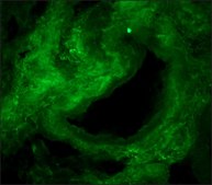 Monoclonal Anti-Collagen, Type I antibody produced in mouse clone COL-1, ascites fluid