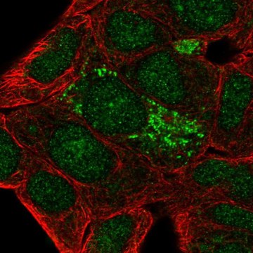 Anti-DHRS2 antibody produced in rabbit Prestige Antibodies&#174; Powered by Atlas Antibodies, affinity isolated antibody