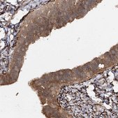 Anti-WDR44 antibody produced in rabbit Prestige Antibodies&#174; Powered by Atlas Antibodies, affinity isolated antibody, buffered aqueous glycerol solution