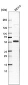 Anti-WEE1 antibody produced in rabbit Prestige Antibodies&#174; Powered by Atlas Antibodies, affinity isolated antibody