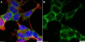 Anti-MEX3A Antibody, clone 1J23 ZooMAb&#174; Rabbit Monoclonal recombinant, expressed in HEK 293 cells