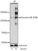 Anti-Phospho-RB(pSer780) Antibody, clone 8R5F5, Rabbit Monoclonal