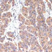 Anti-AP1G1 antibody produced in rabbit