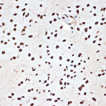 Anti-SET/TAF1 antibody produced in rabbit