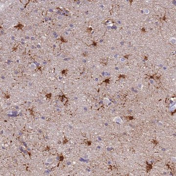Anti-PFKFB2 antibody produced in rabbit Prestige Antibodies&#174; Powered by Atlas Antibodies, affinity isolated antibody, buffered aqueous glycerol solution