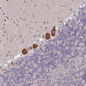 Anti-LARP1 antibody produced in rabbit Prestige Antibodies&#174; Powered by Atlas Antibodies, affinity isolated antibody, buffered aqueous glycerol solution