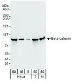 Rabbit anti-Beta-catenin Antibody, Affinity Purified Powered by Bethyl Laboratories, Inc.