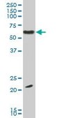 Monoclonal Anti-EBF3 antibody produced in mouse clone 1G3, purified immunoglobulin, buffered aqueous solution