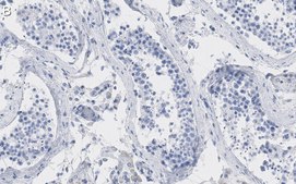 Anti-PKM2 Antibody, clone 1B2 ZooMAb&#174; Rabbit Monoclonal recombinant, expressed in HEK 293 cells