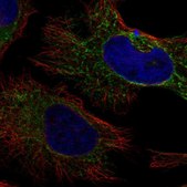 Anti-PDHA1 antibody produced in rabbit Prestige Antibodies&#174; Powered by Atlas Antibodies, affinity isolated antibody, buffered aqueous glycerol solution