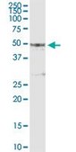 Anti-PIPOX antibody produced in rabbit purified immunoglobulin, buffered aqueous solution