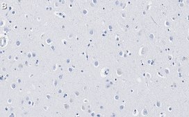 Anti-GAD67 Antibody, clone 4B5 ZooMAb&#174; Rabbit Monoclonal recombinant, expressed in HEK 293 cells