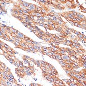 Anti-E-Cadherin antibody produced in rabbit