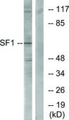 Anti-SF1, N-Terminal antibody produced in rabbit affinity isolated antibody