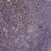 Anti-HMMR antibody produced in rabbit Prestige Antibodies&#174; Powered by Atlas Antibodies, affinity isolated antibody, buffered aqueous glycerol solution
