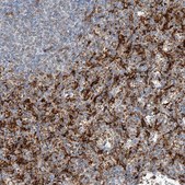 Anti-TBXAS1 antibody produced in rabbit Prestige Antibodies&#174; Powered by Atlas Antibodies, affinity isolated antibody, buffered aqueous glycerol solution